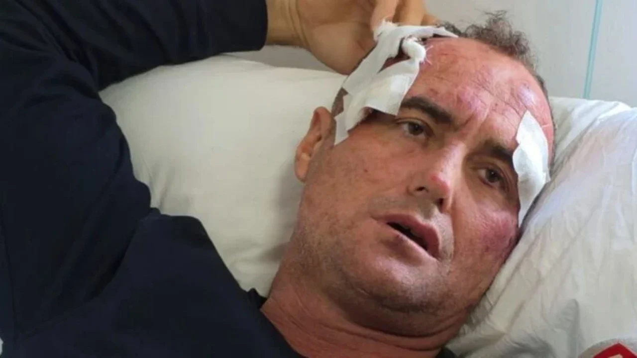 Polici e rrahu se ia bëri  like  dhe i shkroi motrës së tij  reagon qytetari i dhunuar